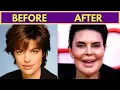 BEFORE AFTER PLASTIC SURGERY CELEBRITIES WHO LOOK TOTALLY DIFFERENT