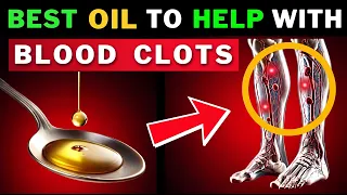 Melt Blood Clots Naturally: Top 6 Powerful Oils