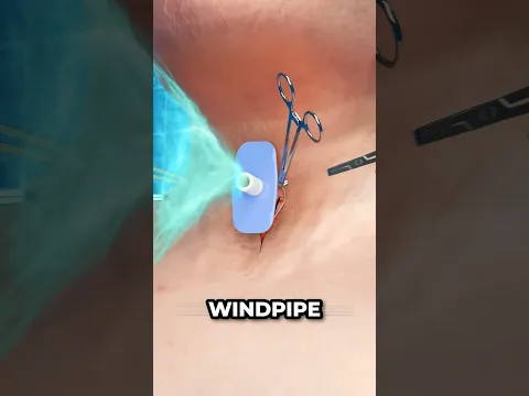 This Device Is What’s Keeping Her Alive
