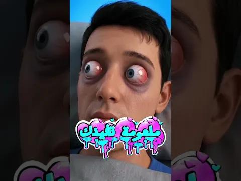ماذا يحدث إذا فقدت جفونك أو توقف جسمك عن إنتاج اللعاب؟#shortvideo