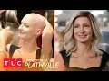 Moriah s Alopecia Journey Welcome to Plathville TLC
