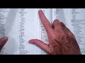 How to assign codes from the ICD 10 PCS coding system