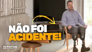 O cirurgião que tinha prazer em amputação!