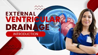 Mastering External Ventricular Drainage Your Ultimate Guide