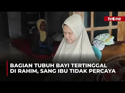 Geger! Kepala Bayi Tertinggal saat Sang Ibu Melahirkan