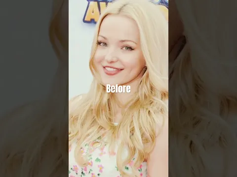 Download MP3 Dove Cameron before and after