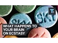 Download Lagu An addiction specialist reveals what happens to your brain on Ecstasy