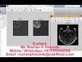 Matlab code for Image Fusion using Wavelet Transform