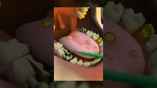 Dental Problem Asmr Asmrvideo Asmrsounds Animation Dental Dentist Doctor Shorts Tretment 