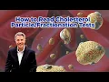 How to Read Cholesterol Tests
