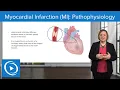 Myocardial Infarction MI Pathophysiology - Med-Surg Nursing Lecturio Nursing