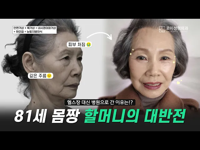 81세 몸짱 할머니, 왜 헬스장이 아니라 병원을 선택했을까?