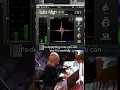 Tighten up your drum mix here s how phase alignment changes everything