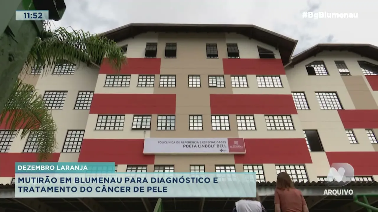 Dezembro Laranja: mutirão em Blumenau para diagnóstico e tratamento do câncer de pele