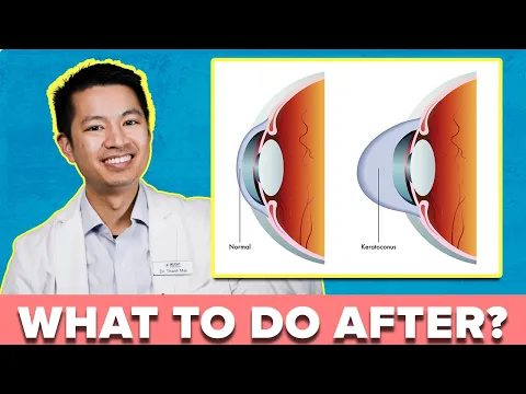 The #1 Thing to Do After Being Diagnosed With Keratoconus!!! OC Contact Lens Doctor Shares