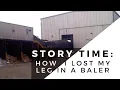 Download Lagu Story Time: How I Lost My Leg | Baler Accident