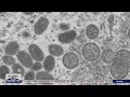 Washington Department of Health to give update on monkeypox response FOX 13 Seattle
