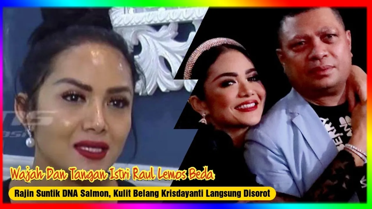 Rajin Suntik DNA Salmon, Kulit Belang Krisdayanti Langsung Disorot, Wajah dan Tangan Istri Raul Beda