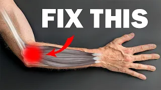 How To Fix Tennis Elbow: 2 PROVEN Ways
