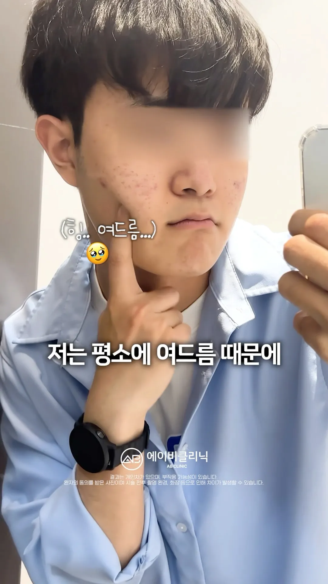 주기적으로 받는 여드름 박멸 패키지💧