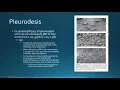 Pleural Effusions and Pneumothorax