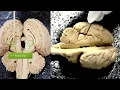 Sheep Brain Dissection Review Anatomy Practical Exam Guide Cranial Nerves