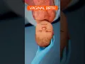 Download Lagu Vaginal Birth ❤️ How the baby is born #shorts #pregnancy #baby #3danimation #labor #miracle