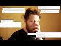 Your HAIR SYSTEM Questions Comments Answered - Hair System Help