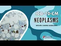 ICD-10-CM Specific Coding Guidelines - Neoplasms Part ONE