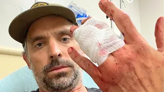 I Almost Went to Nine Fingers...Take Off The Ring (Ring Avulsion)