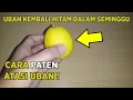 Download Lagu Rambut Uban Hilang Dengan Cara Ini
