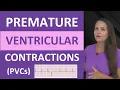 Premature Ventricular Contractions PVCs ECG Nursing NCLEX Bigeminy Trigeminy