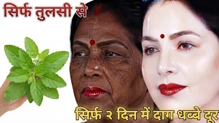 चेहरे पर तुलसी को इस तरह मिलाकर लो, शरीर पर जमा जिद्दी मैल के दाग मिनट में साफ, दूध जैसा गोरा/Skin
