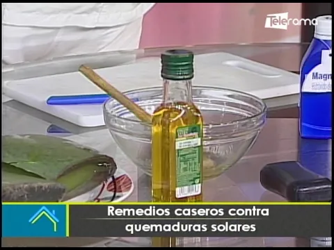 Remedios caseros contra quemaduras solares
