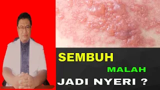 kenapa penyakit herpes sembuh tapi kulit menjadi nyeri 