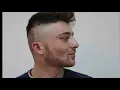Download Lagu Beard Transplant Surgery AMAZING Result HLC Clinic Transplant Turkey