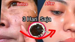 TANPA MODAL!! Habisi Tuntas Flek Keriput !! Wajah Tua Jadi muda!!