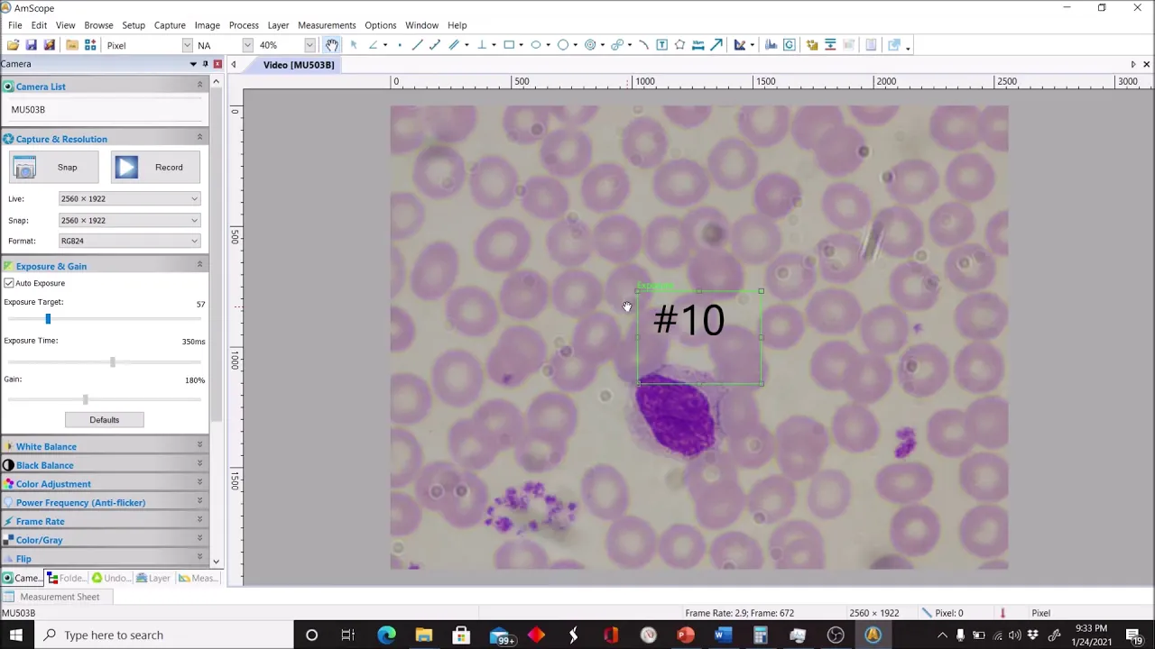 Conducting a Differential WBC Count with Human Blood