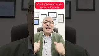 حاجات طبيعيه تعالج الشوكه العظميه بالكعب وتذوبها نهائيا 