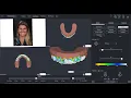 The Fastest Way to Get Print-Ready Dental Models
