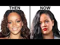 Has Rihanna Had Plastic Surgery