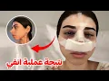 Download Lagu اخيرا نتيجة انفي بعد عملية تجميل..👃🏻