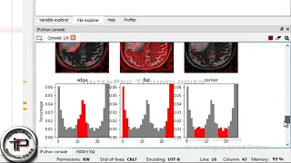 Final Year Project Brain Tumor Classification In MRI Using CNN KNN SVM Algorithm In PYTHON