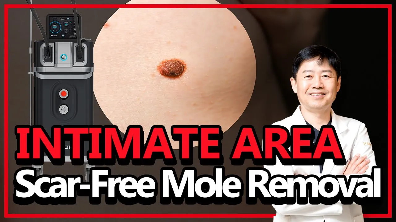Safe. Scarless. Mole Removal.