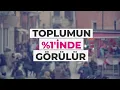 Prof Dr Ersin Erdoğan Epilepsi ve Tedavisi