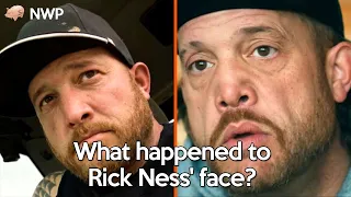 What happened to Gold Rush star Rick Ness face