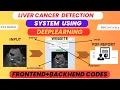 Liver Cancer Detection Using Ultrasound Images Deep Learning IEEE Final Year Project with Full Code