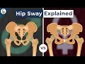 Why Do Women s Hips Sway When They Walk