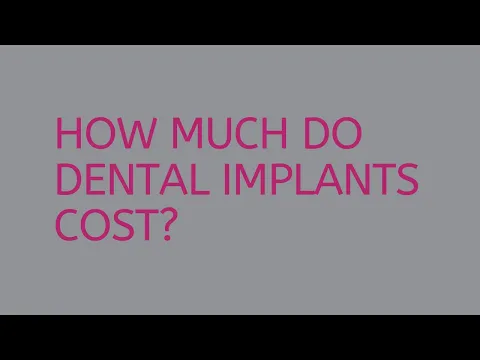 Download MP3 How much do dental implants cost? | Colin Campbell