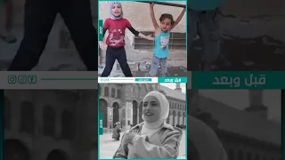 الله لايوفقك يا بشار الطفلة آية كيف أصبحت بعد التحرير سوريا راديو طيف سوريا حرة 